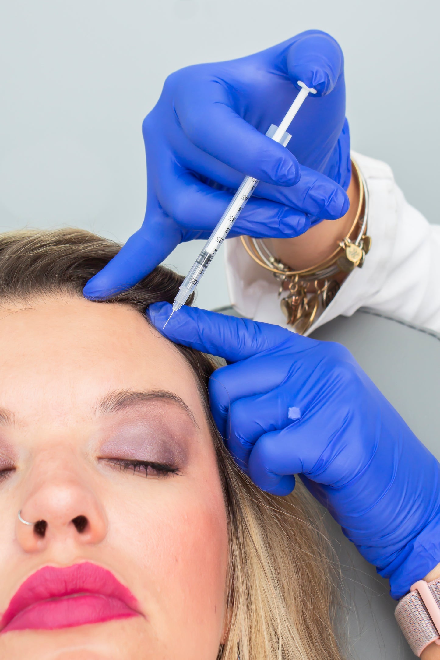 PARTY PREP PERFECTION: 40 Units of Tox + 1 Filler with location of choice!